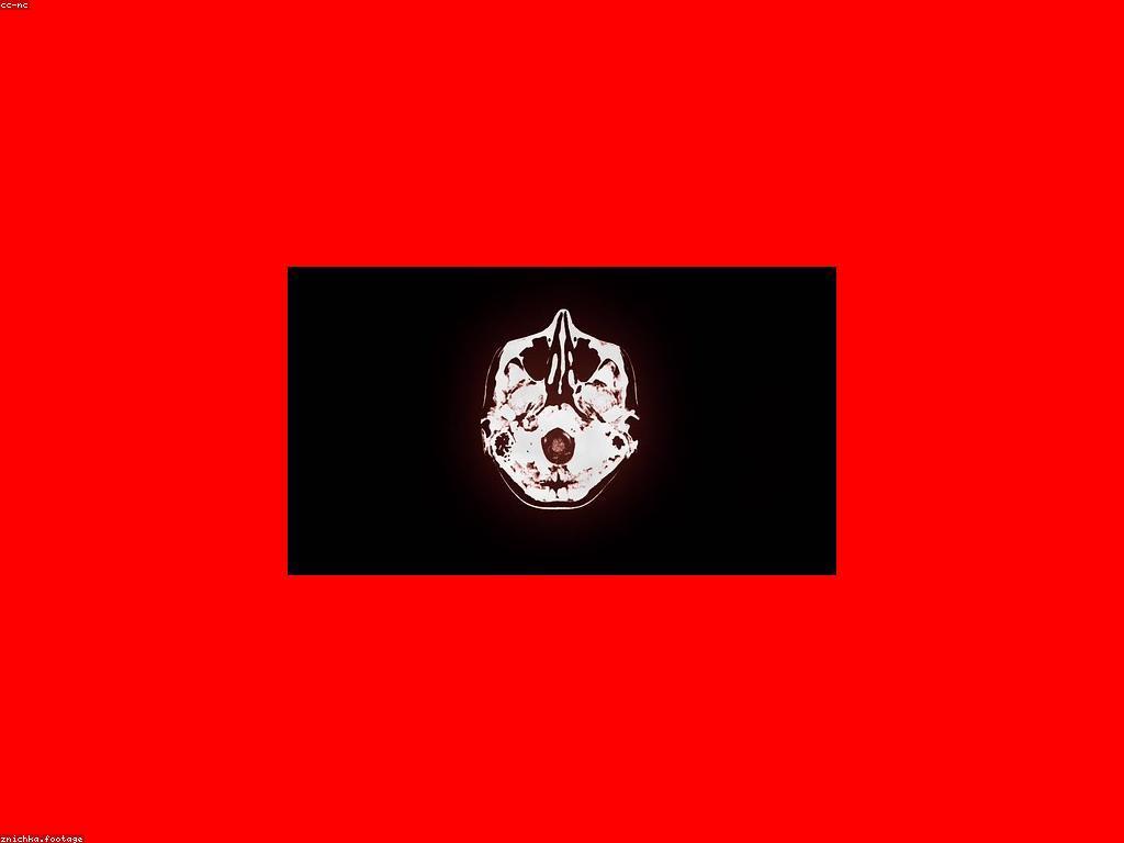 ការពិចារណា និង វិធីសាស្ត្រផ្សំឡើងសមត្ថភាព